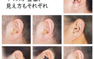 安心の保証｜補聴器の修理
